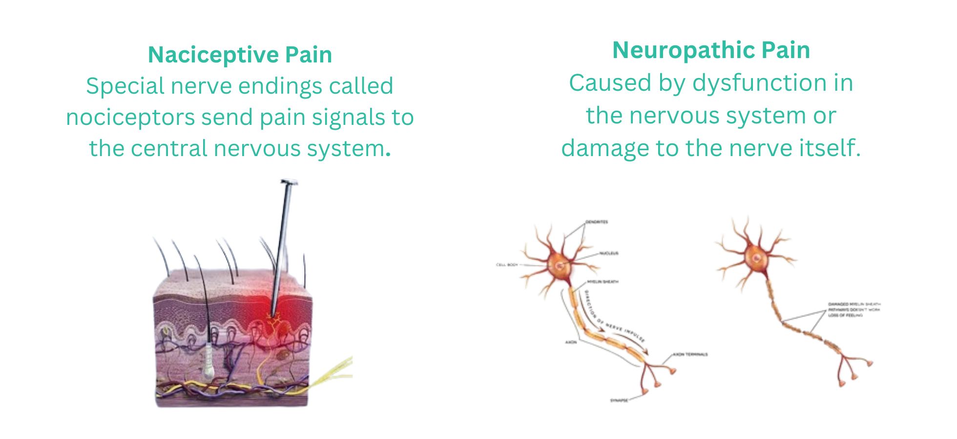 Explain Nociceptive Pain & Neuropathy pain 